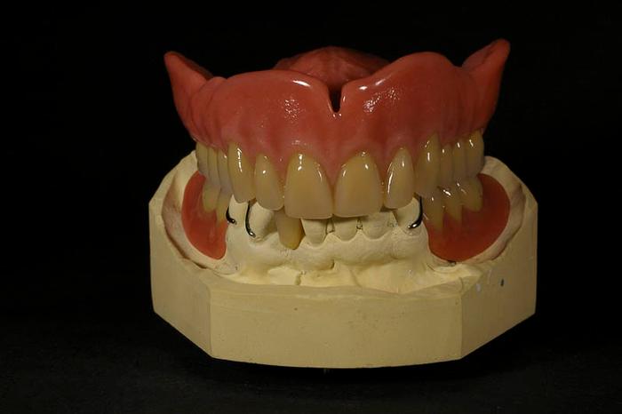 Zahnprothese