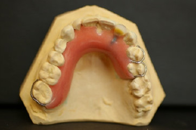 Zahnprotesen gasser-zahntechnik