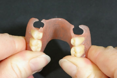 Zahnprotesen gasser-zahntechnik